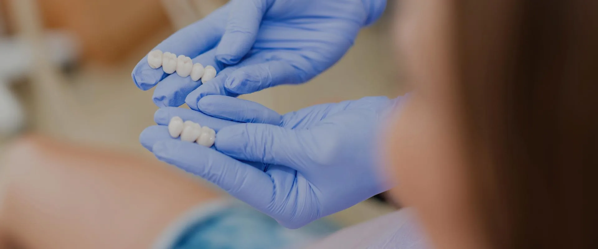 Roseville dentist Dr. Haney showing how dental crowns could help restore a patient's smile