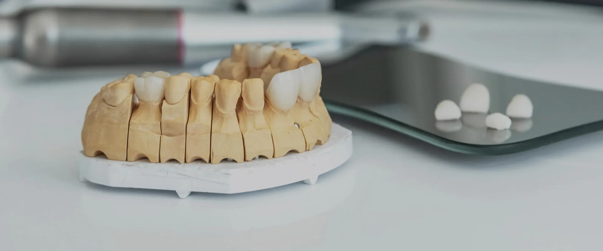 model of dental implants to show how they can help restore your smile