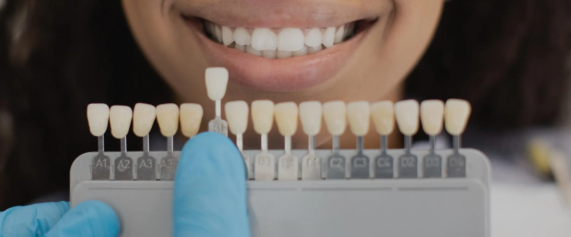 Dr. Haney helping a patient choose which color dental veneers they would like